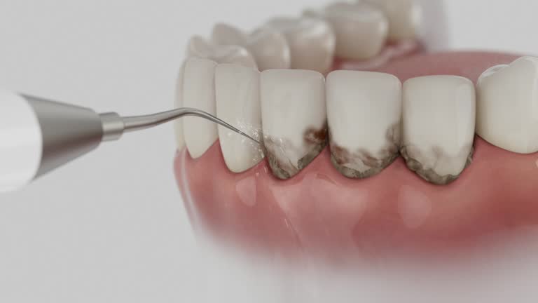 Trusted Root Canal Treatment service in Kyle, SD - Dentist Open Now
